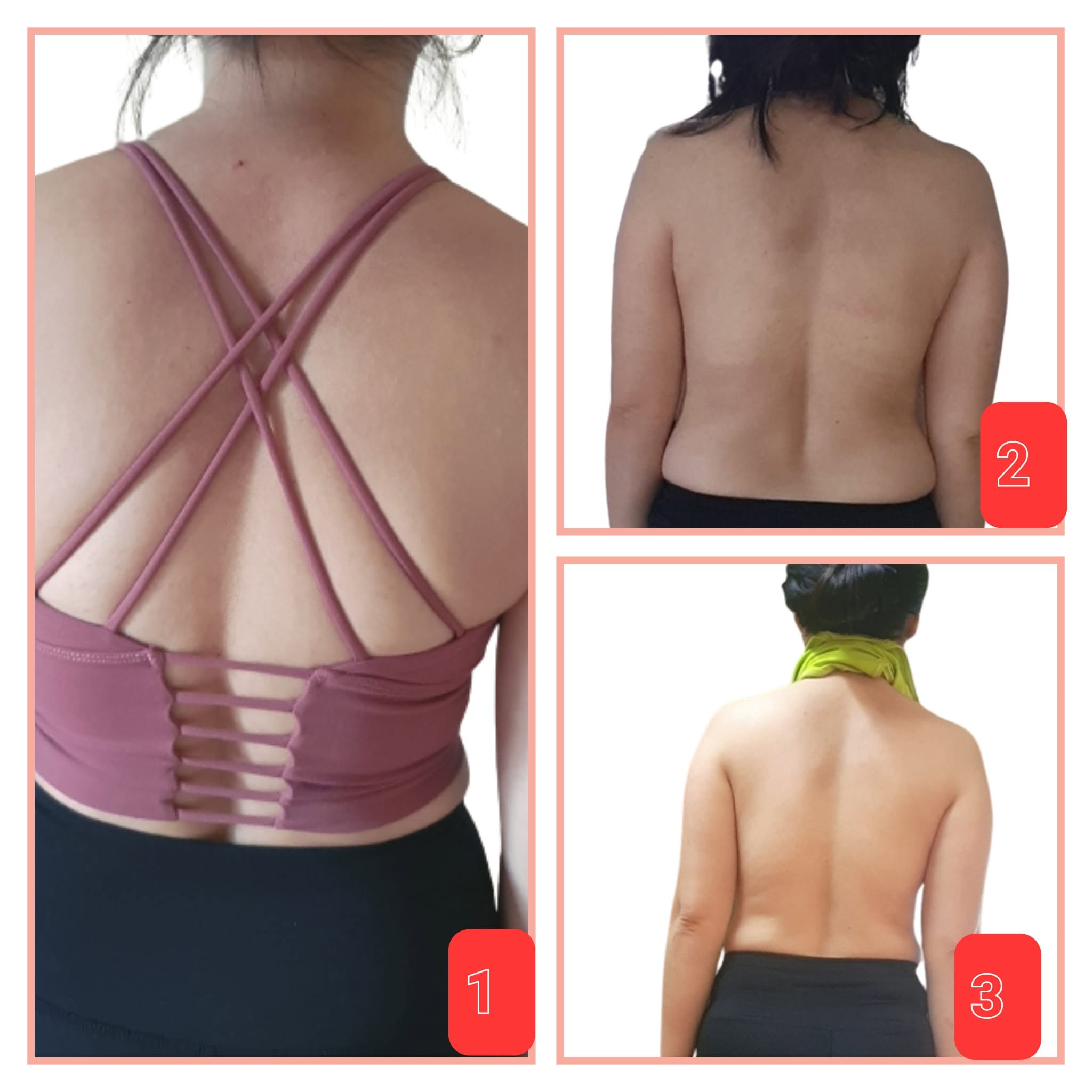 Ba ảnh lưng học viên qua các giai đoạn tập: cột sống và vai cân đối dần